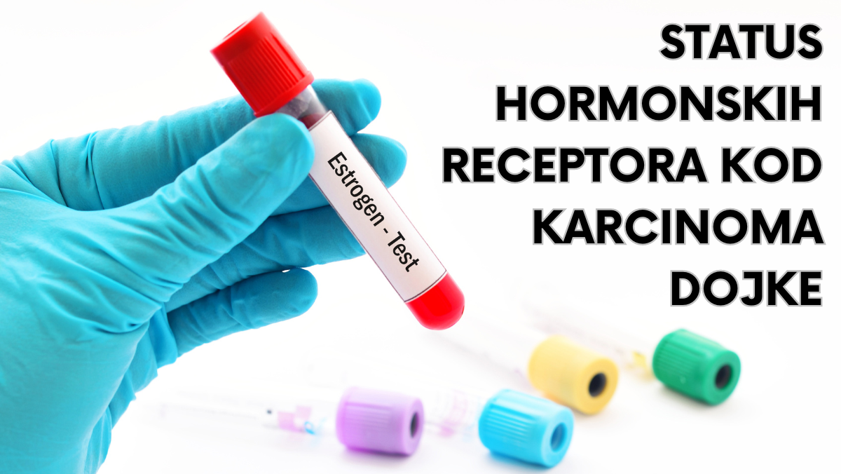 Status hormonskih receptora kod karcinoma dojke